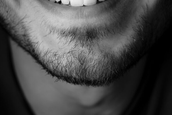 Fallegar Tennur - Fedasz Dental - Myndir 20244 copy