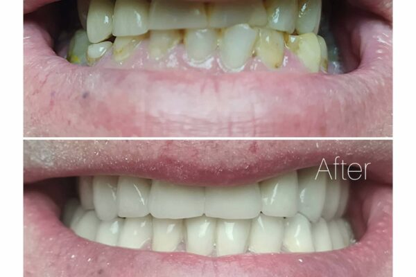 Fallegar Tennur - Fedasz Dental - Myndir51bc545a-28b4-4802-af31-4dc316957b21