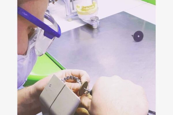 Fallegar Tennur - Fedasz Dental - Myndirb1b626cb-50bf-42a8-9e6e-e82b614c269b