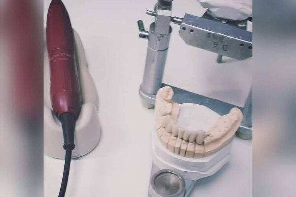 Fallegar Tennur - Fedasz Dental - Myndirbcde50eb-ab7d-4810-bd23-b32bf9ab47a8