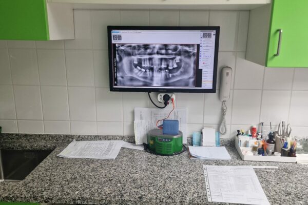 1 - Fedasz Dental Clinic - Fallegar tennur3